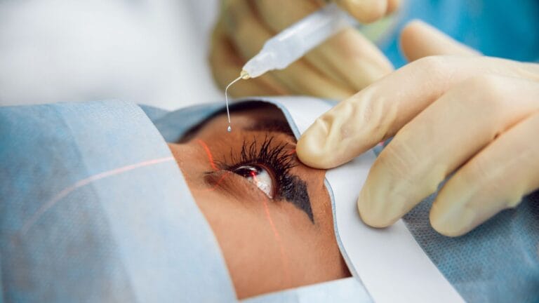 Cataract Surgery